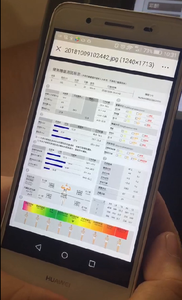 Báscula Inteligente Digital Profesional BECO para Análisis de Grasa Corporal con Detección de Elementos <span class=keywords><strong>del</strong></span> <span class=keywords><strong>Cuerpo</strong></span> <span class=keywords><strong>Humano</strong></span>, Máquina de Cuidado Personal - Product Image 6