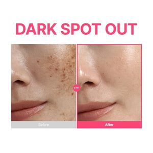 PURITO TXA 6% + Niacinamide 10% + Retinal Facial Serum for Home Use Targets Dark Spots Hyperpigmentation Uneven Tone All <b>Skin</b> - Product Image 3