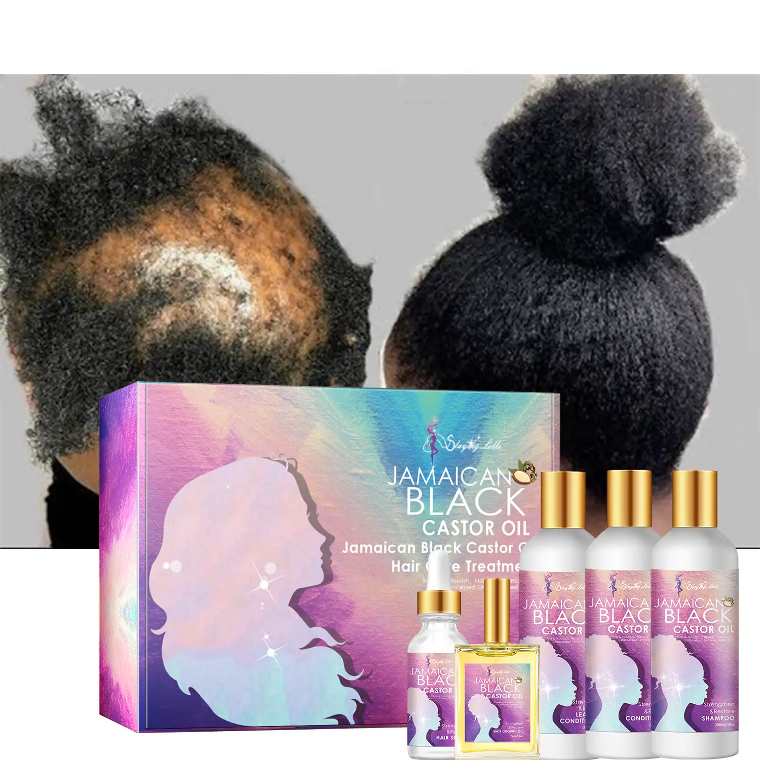 में सुधार खोपड़ी स्वास्थ्य और पोषण जड़ों अफ्रीकी हर्बल बाल विकास तेल तेल बालों की देखभाल उत्पादों काले महिलाओं के लिए