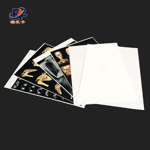 China Kenid Agfa Fuji Digunakan Dalam Pembuatan Film Thermal Medis Kering Printer Medis X-Ray Film - Product Image 3