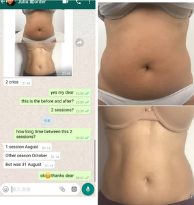 Máy Làm Thon Gọn Đông Lạnh EMS Nhiệt 4.0 Tshock Mới Nhất Máy Trị Liệu Đông Lạnh Giảm Cellulite Cho Mặt Cơ Thể - Product Image 3