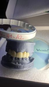 <span class=keywords><strong>Vsmile</strong></span> HappyZir Bloc de Zircone Multicouche SHT 46% Translucide Matériaux Céramiques Dentaires Postérieurs et Antérieurs 10mm Certifié CE 5 - Product Image 3