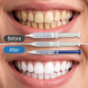 Gel Blanqueador <span class=keywords><strong>Dental</strong></span> con Peróxido de Carbamida Seguro para Esmalte, en Jeringa, <span class=keywords><strong>Precio</strong></span> al por Mayor, Gel Blanqueador <span class=keywords><strong>Dental</strong></span> Portátil para Compradores B2B - Product Image 4