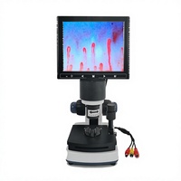 Instrument de surveillance de la microcirculation haute définition 1200 fois plus performant avec écran LCD d'observation biologique