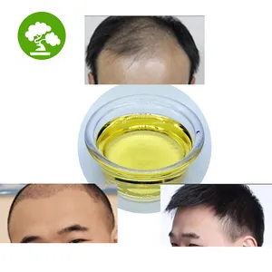 Óleo De Crescimento De Cabelo Puro 99% Castor Oil