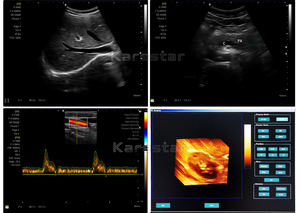 Vente directe d'usine, échographe portable couleur Doppler numérique complet LED 4D 3D pour vétérinaires - Product Image 5