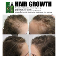 Semprotan Nutrisi Pertumbuhan Rambut Alami Organik, Kuat dan Tahan Lama, Anti Rontok dan Melembapkan