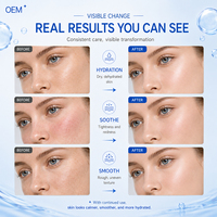 Sérum injectable réparateur pour peaux sensibles, formule hydratante apaisante instantanée, protection légère, booster d'essence de Centella