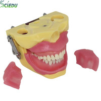 Modèle dentaire, modèle de dents, modèle d'extraction dentaire, équipement pédagogique pour les écoles de médecine, modèle d'anatomie dentaire médicale