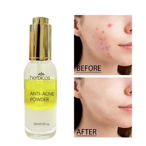 ODM/OEM เซรั่มสองชั้นสำหรับผิวหน้า<span class=keywords><strong>สิว</strong></span>ทำให้สิวสว่างขึ้นผลิตภัณฑ์รักษาสิวผลิตภัณฑ์รักษา<span class=keywords><strong>สิว</strong></span>ผงเซรั่ม<span class=keywords><strong>น้ำ</strong></span> - Product Image 3