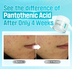 Polvo Secante Activo Pantoténico B5 N.° 1, Tratamiento para el Acné, Control de Grasa, Minimiza los Poros, Repara la Piel, Cuidado Diario de la Piel - Product Image 3