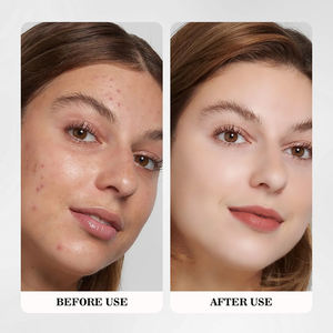 Crème Visage Blanchissante à l'Acide Hyaluronique de Haute Qualité 1 kg Vente en Gros Nourrissante Hydratante Squalane Crème Blanchissante pour la Peau - Product Image 5