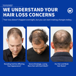 カスタムロゴ入り180mlバリューパック 天然頭皮ケア育毛液 厚みのある髪を育てる男性用育毛トリートメント - Product Image 2