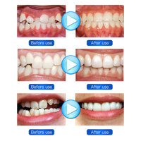 Protège-dents orthodontique souple en TPE couleur personnalisée pour alignement dentaire, entraîneur de dentition, protège-dents de sport, double protège-dents