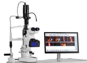 Lámpara de Hendidura de Alta Resolución de Nuevo Estilo con Adaptador Digital y Divisor de Haz para Examen Oftalmológico - Product Image 2