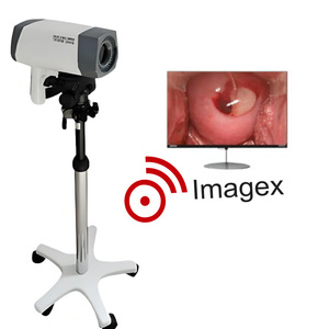 <span class=keywords><strong>Vaginoscope</strong></span> électronique numérique Colposcope vidéo pour examen gynécologique - Product Image 3