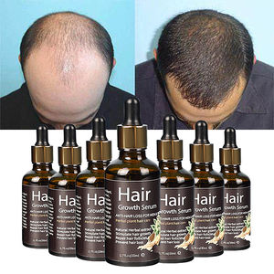 Óleo Sérum de Gengibre para Crescimento Capilar em 7 Dias Marca Própria para Pessoas Negras Tratamento do Couro Cabeludo Óleo de Alta Qualidade para Reparação do Folículo Piloso - Product Image 1