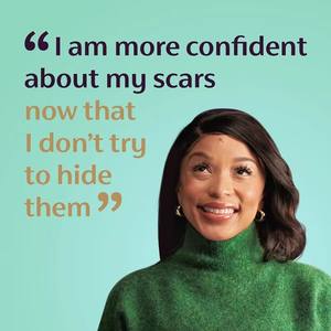 Gel réparateur de cicatrices à action rapide ENWEI EW017, crème réparatrice de la peau, tube à bille, emballé pour l'acné, les vergetures, les soins post-chirurgie - Product Image 3