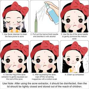 Extracteur de points noirs professionnel en métal, double extrémité, aiguille durable <span class=keywords><strong>pour</strong></span> le nettoyage de l'acné, extracteur de points noirs et de boutons - Product Image 6