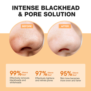 Skinever Hữu Cơ salicylic axit Chất thiết lập mụn đầu đen làm sạch và lỗ chân lông giảm thiểu mũi huyết thanh - Product Image 4