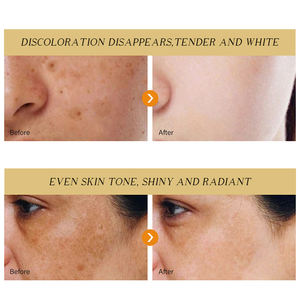Etiqueta privada Cuidado de la piel facial Belleza Antienvejecimiento Reduce las arrugas Reparación efectiva Se desvanecen Pecas Crema facial para eliminar manchas oscuras - Product Image 2