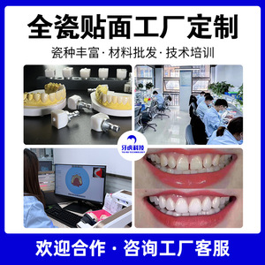 วีเนียร์เซรามิกทั้งชิ้น, วัสดุทันตกรรมยี่ห้อ Yi Huojia, วีเนียร์ฟอกฟันขาวและเพิ่มความสดใส, การเรียนรู้และการสอน, ใช้งานได้ยาวนาน - Product Image 5