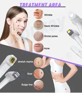 Máquina fracionária de micro-needing para remoção de rugas e cicatrizes, rejuvenescimento da pele, remoção de acne e cicatrizes, lifting da pele, vmax