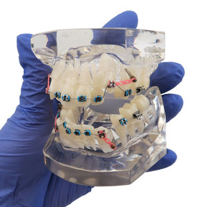 Modelo de Ortodoncia con Brackets Metálicos, Modelo de Práctica de Ortodoncia para Estudio Dental - Product Image 6