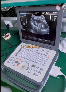 C12 Advanced Desktop Ultrasound dengan Probe 128 Elemen Diagnosa Optik Ultrasound Warna Doppler untuk Rumah Sakit Klinik - Product Image 4