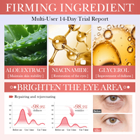 Crème pour les yeux à la pastèque et au niacinamide, marque privée OEM SADOER, best-seller en gros, nourrissante et hydratante