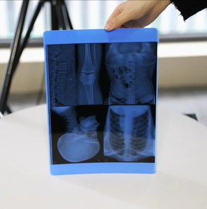 Película radiográfica térmica seca económica azul para uso médico 8x10-14x17, compatible con DR CR CT MRI, Agfa 5302 <span class=keywords><strong>Fuji</strong></span> Drypix Series - Product Image 3