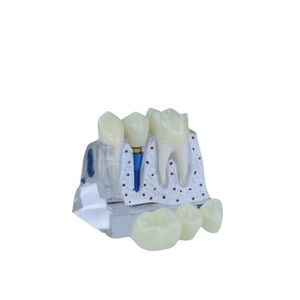 Modelo Dental de Plástico Resistente, Ampliado 4 Veces, Modelo de Enseñanza para Médico-Paciente, Accesorios Multiusos para Blanqueamiento Dental - Product Image 6