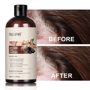 Hot Selling Nuspa Merk Gember Haargroei Shampoo Natuurlijke Snelle Haargroei Behandeling Anti Haaruitval Shampoo