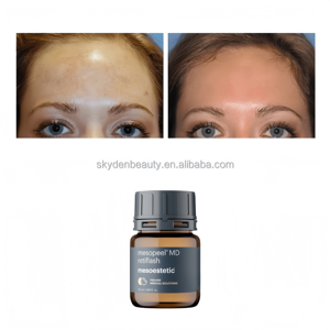 Cosmelan, el Exfoliante Químico AHA Más Vendido para Piel Oscura y Sensible, Proveedores de Mesoestetic Cosmelan en Mercados y Plataformas de Compras en Línea - Product Image 4