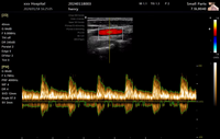 Appareil d'échographie Doppler couleur 3D HD de haute qualité, 15,6 pouces, portable, scanner vétérinaire pour chien, chat, équipement médical pour hôpital