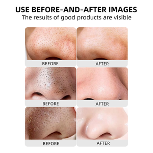 Loción Exfoliante de Alta Gama OEM y ODM de 30 ml, Líquido Exfoliante Suave <span class=keywords><strong>para</strong></span> Piel Muerta y Puntos Negros, Ampolla Exfoliante <span class=keywords><strong>para</strong></span> Puntos Negros - Product Image 6