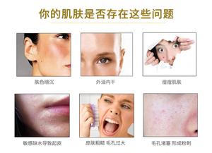 แผ่นมาส์กหน้าคอลลาเจนทองคำ 24K ลดเลือนริ้วรอย ขายส่ง - Product Image 5