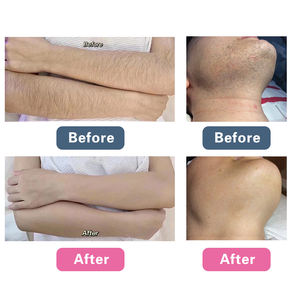 60% off <span class=keywords><strong>laser</strong></span> dioda CE medis penghilang rambut 808 es titanium trio <span class=keywords><strong>laser</strong></span> 4D diodo 4d remodao pelos Peralatan Kecantikan - Product Image 6