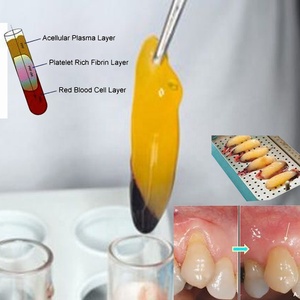 10 ml i PRF 튜브 치과 PRF 원심 분리기 튜브 - Product Image 6