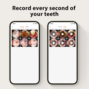 Bebird Limpiador de oidos con Camara kulak temizleme cihazl dụng cụ kiểm tra răng miệng với máy ảnh - Product Image 4