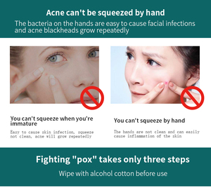 High Quality Stainless Steel Acne Removal Needle <strong>Blackhead</strong> Remover Comedone <strong>Extractor</strong> Face <strong>Tools</strong> - Product Image 6