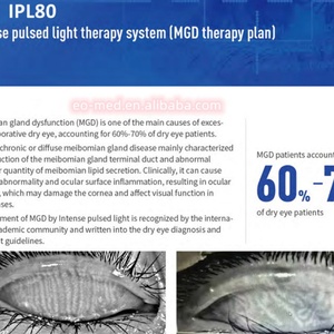 Appareil ophtalmique IPL80 pour le traitement des troubles des glandes de Meibom par système de thérapie à la lumière pulsée intense pour les patients souffrant de sécheresse oculaire - Product Image 2