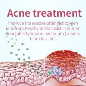 DEESS GP591 3 in 1 ipl epilasyon cihazı kadınlar için ağrısız saç çıkarıcı yüz epilasyon cihazı - Product Image 5