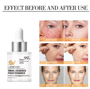 Produits de soin de la peau coréens en gros, marque privée OEM, hydratant, <span class=keywords><strong>essence</strong></span> de mucine d'escargot originale 99%, sérum d'escargot pour le visage - Product Image 3