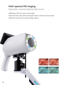 <strong>Kernel</strong> GN-300 HD Digital Video Colposcope Class I Surgical Instruments for Gynecologic Surgery Cervical Lesion Diagnosis 1 Year - Product Image 3