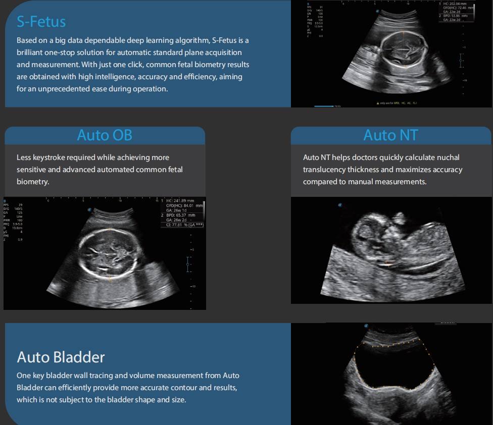 新到超声机4D/SonoScape超声便携性AVC-卵泡S-胎儿| Alibaba.com