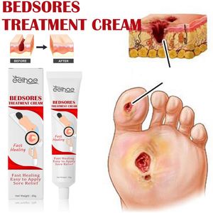 Crema Reparadora Natural para la Piel EELHOE, Ungüento Curativo para Heridas, Crema para Úlceras por Presión, Trata y Calma Quemaduras y Ulceras Cutáneas - Product Image 5