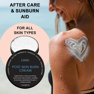 Etiqueta privada Post Skin Burn Cream Sunburn Cream <span class=keywords><strong>para</strong></span> el tratamiento de primeros auxilios Hidrata repara la piel con <span class=keywords><strong>heridas</strong></span> de manteca de karité de <span class=keywords><strong>Aloe</strong></span> Vera - Product Image 5