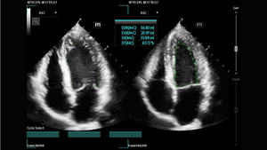 Sistem USG Diagnostik Doppler Warna 3D 4D Berkualitas Tinggi Mindray TEX20 Buatan China untuk Penggunaan Hewan - Product Image 5