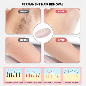 Vente en gros 2025 Meilleur épilateur laser pour le visage à lumière pulsée Machine d'épilation portable à usage domestique Dispositif d'épilation Ipl - Product Image 4